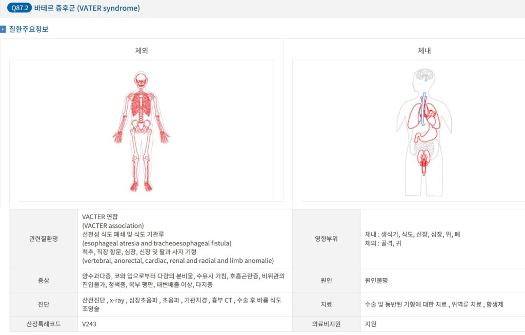 바테르증후군