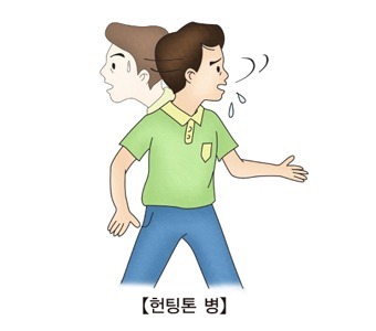 헌팅턴-무도병