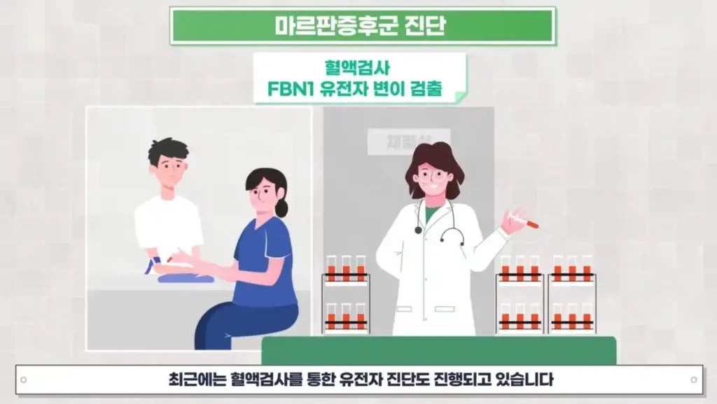 마르판증후군 테스트