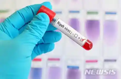 니파바이러스 관련주 및 니파 바이러스 증상 베트남 국내 상황 니파바이러스 국내
