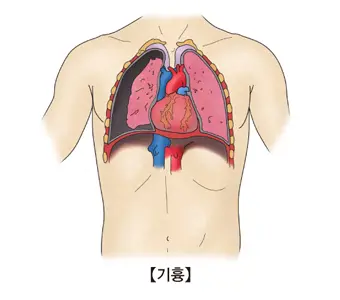 폐기흉 증상 원인과 치료, 수술 비용 · 군대 면제까지 총정리 폐기흉