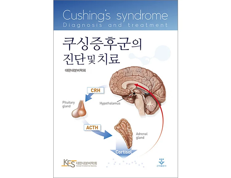 쿠싱증후군 원인 증상 진단 치료 쿠싱증후군 진단