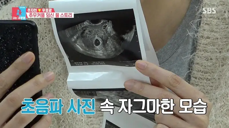임신 극초기증상 시기